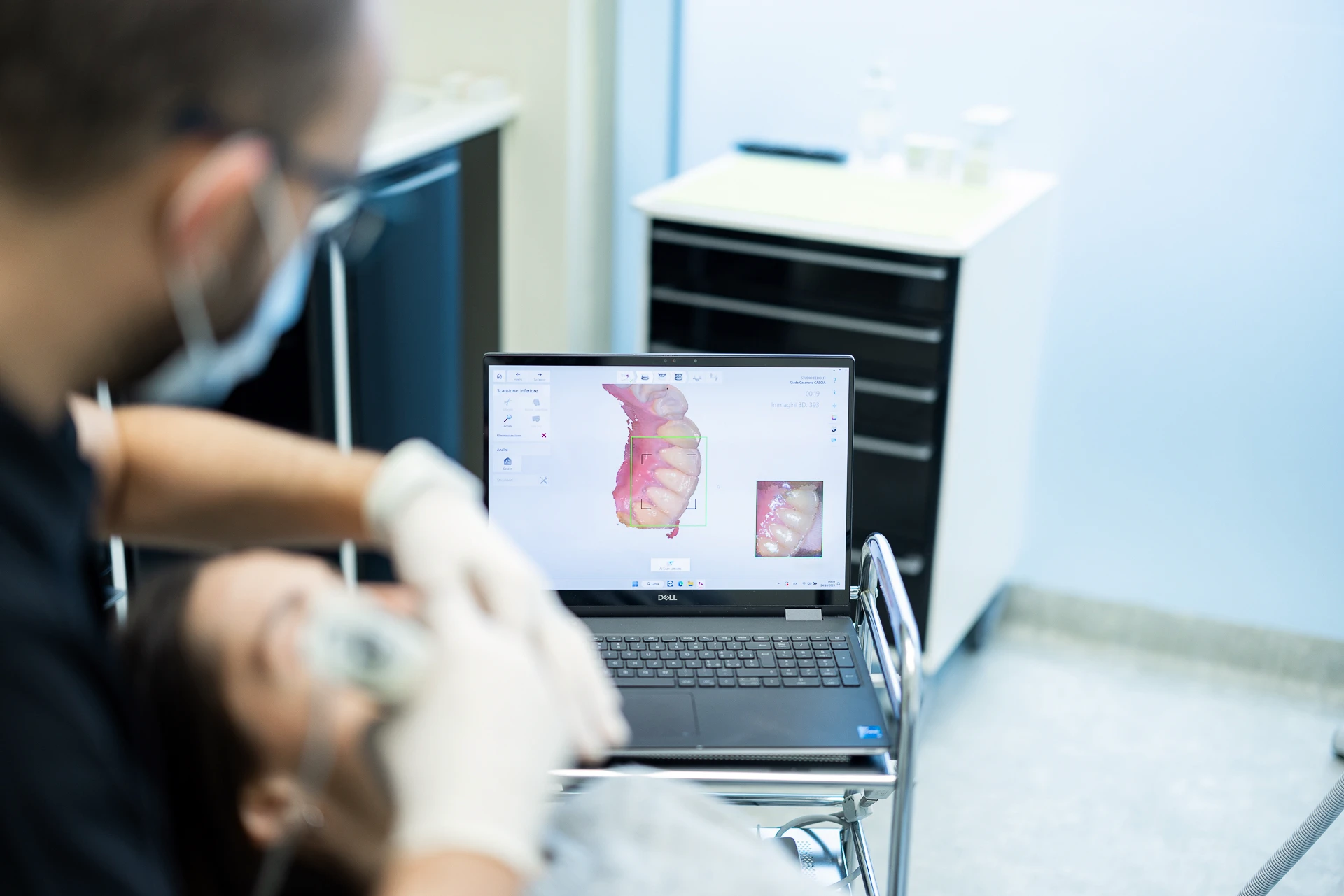 Odontoiatria digitale al Centro Redolfi di Flero: scansione intraorale 3D per impronte dentali precise senza l'uso di paste fastidiose.